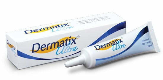 Các liệu pháp làm mờ sẹo lồi bằng Dermatix Ultra