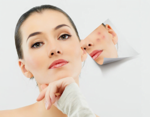 Cách làm mờ vết thâm trên mặt với Dermatix ultra