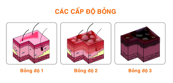 cac-cap-do-bong